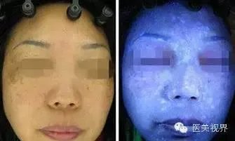 你买到过毒面膜吗，是否有毒面膜名单可以参考？