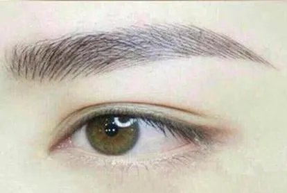 做双眼皮开眼角安全吗