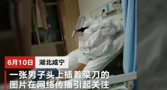 湖北一男子头插菜刀在医院等候治疗 宛如电影场景！