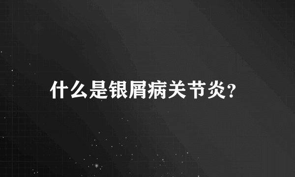 什么是银屑病关节炎？