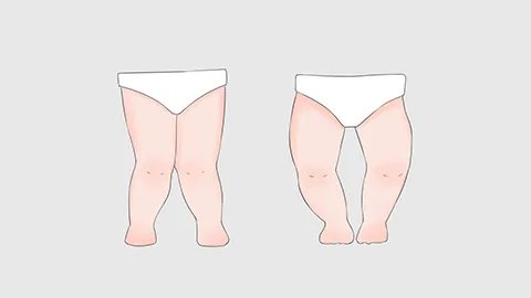 膝盖骨膜炎症状表现是什么