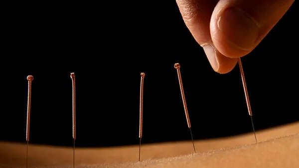 中医怎样治输卵管堵塞