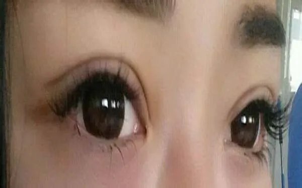 北京医院哪家做去眼袋好？