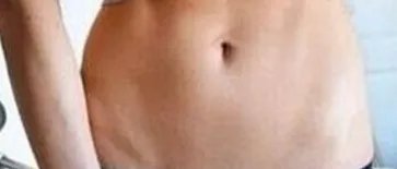 腹部抽脂的价格贵吗