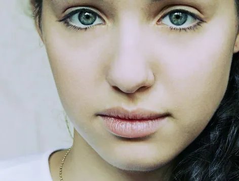 果酸换肤后的注意事项