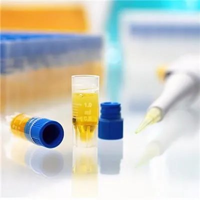 肾病综合征能活多久