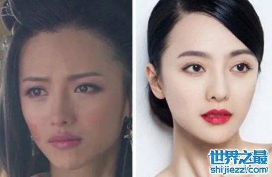 张芷溪整容前后对比照片，面部整容疤痕清晰可见 