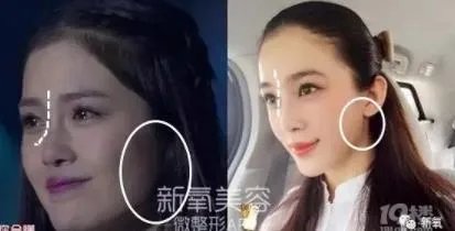 赵韩樱子整容前后：赵韩樱子是姓什么