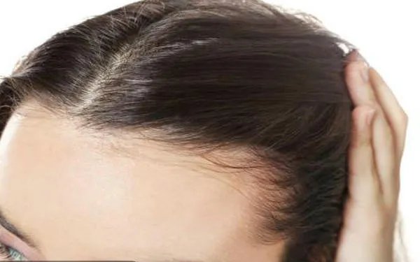 种植发际线需要多少钱