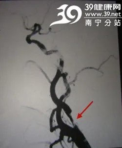 访瑞康医院神经内科主任任丁