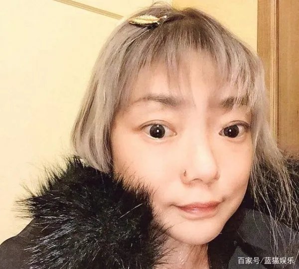 8年后由花容月貌变得骨瘦如柴