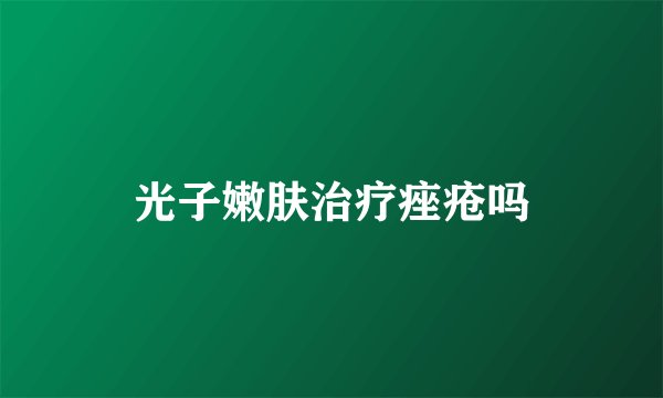 光子嫩肤治疗痤疮吗