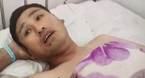 患者右腿做手术左腿被误割开医院怎么说？