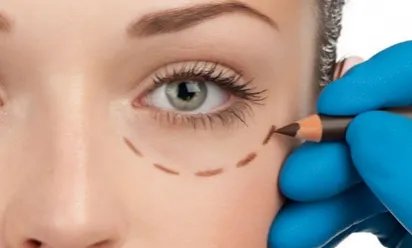 有了眼袋怎么去除	