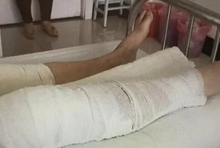 患者右腿做手术左腿被误割开医院怎么说？