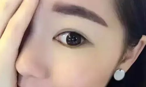 纹眉的价格是多少