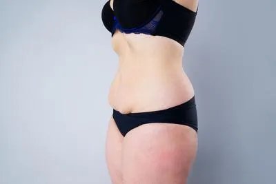 大腿内侧友好多赘肉该怎么减