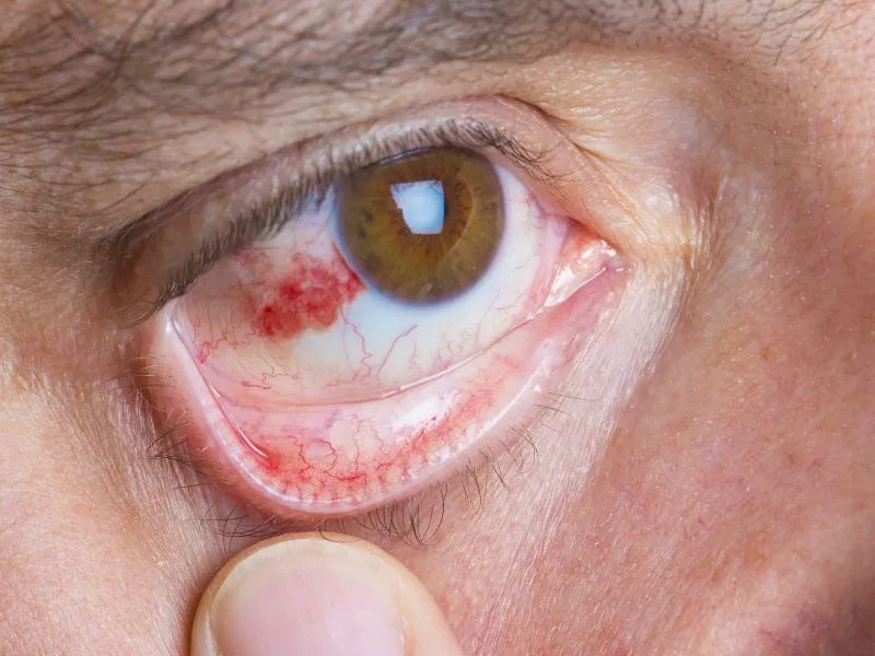 拔云锭眼药水有哪些疗效