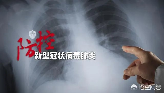 为什么意大利先大面积爆发了疫情？