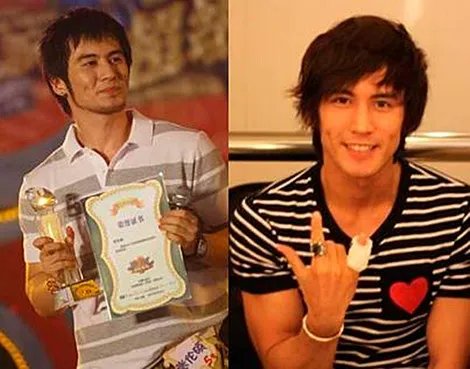 张伦硕整容前后对比照 张伦硕跳水露大鸟照惊呆女嘉宾