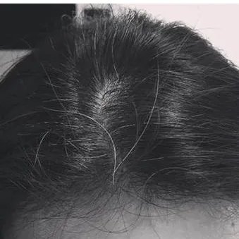 舒淇 白发是怎么回事？