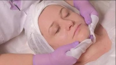 脸部红血丝去除方法有哪些