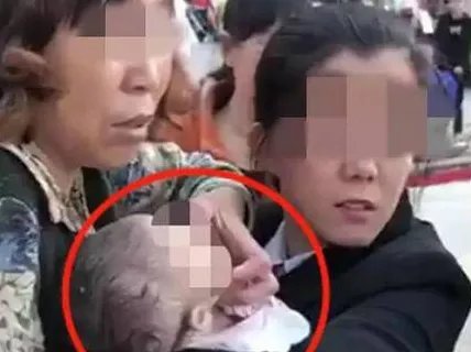 楼上扔苹果砸中女婴现状如何？