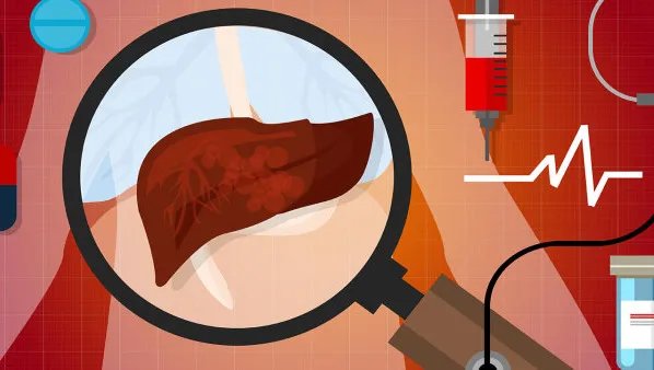 丙肝的治疗方法