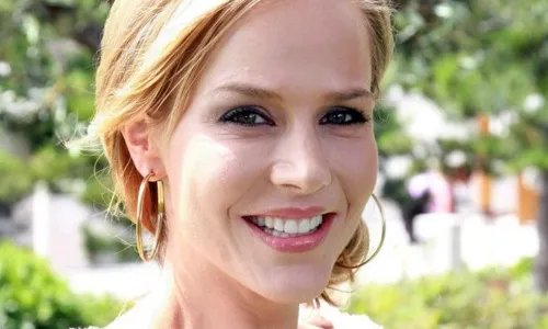 抬头纹可以打玻尿酸吗