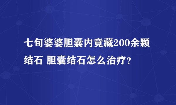 七旬婆婆胆囊内竟藏200余颗结石 胆囊结石怎么治疗？