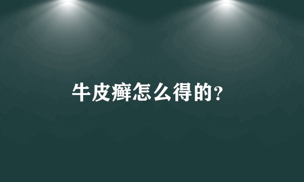 牛皮癣怎么得的？
